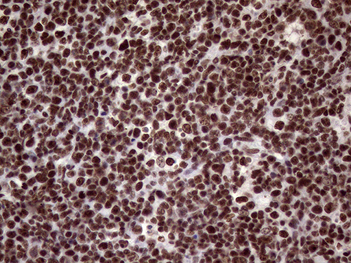 XRN2 Antibody - Immunohistochemical staining of paraffin-embedded Human lymph node tissue within the normal limits using anti-XRN2 mouse monoclonal antibody. (Heat-induced epitope retrieval by 1mM EDTA in 10mM Tris buffer. (pH8.5) at 120°C for 3 min. (1:2000)