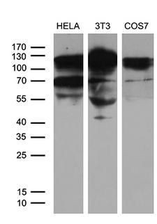 XRN2 Antibody - Western blot analysis of extracts. (35ug) from 3 different cell lines by using anti-XRN2 monoclonal antibody. (1:500)