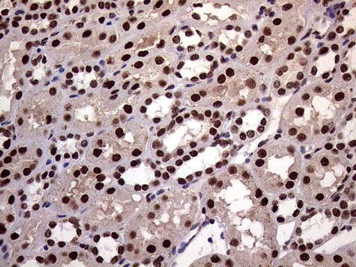 XRN2 Antibody - Immunohistochemical staining of paraffin-embedded Human Kidney tissue within the normal limits using anti-XRN2 mouse monoclonal antibody. (Heat-induced epitope retrieval by 1mM EDTA in 10mM Tris buffer. (pH8.5) at 120°C for 3 min. (1:2000)