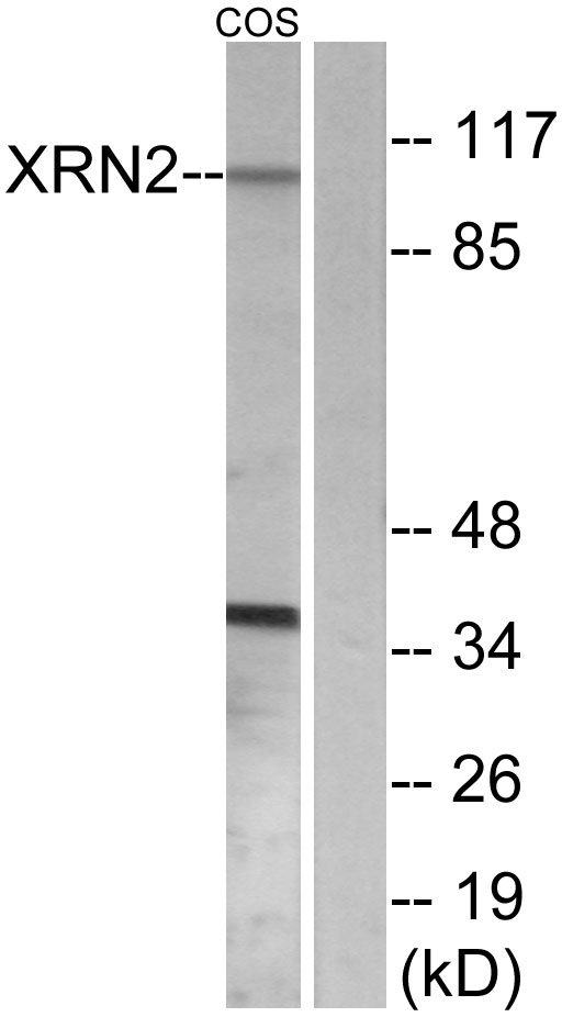 XRN2 Antibody - Western blot analysis of lysates from COS7 cells, using XRN2 Antibody. The lane on the right is blocked with the synthesized peptide.