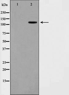 XRN2 Antibody - Western blot analysis on COS7 cell lysates using XRN2 antibody. The lane on the left is treated with the antigen-specific peptide.
