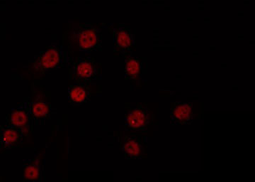 XRN2 Antibody - Staining COS7 cells by IF/ICC. The samples were fixed with PFA and permeabilized in 0.1% Triton X-100, then blocked in 10% serum for 45 min at 25°C. The primary antibody was diluted at 1:200 and incubated with the sample for 1 hour at 37°C. An Alexa Fluor 594 conjugated goat anti-rabbit IgG (H+L) Ab, diluted at 1/600, was used as the secondary antibody.
