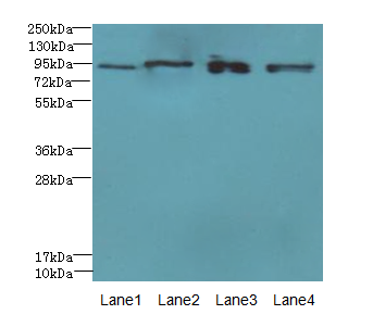 XRRA1 Antibody - Western blot. All lanes: XRRA1 antibody at 6 ug/ml. Lane 1: HepG-2 whole cell lysate. Lane 2: Mouse kidney tissue. Lane 3: HL60 whole cell lysate. Lane 4: U251 whole cell lysate. Secondary Goat polyclonal to Rabbit IgG at 1:10000 dilution. Predicted band size: 90 kDa. Observed band size: 90 kDa.