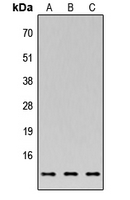 XTP4 / C17orf37 Antibody - Western blot analysis of C35 expression in MCF7 (A); NS-1 (B); PC12 (C) whole cell lysates.