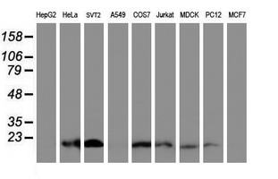 XTP4 / C17orf37 Antibody - Western blot of extracts (35ug) from 9 different cell lines by using anti-C17orf37 monoclonal antibody (HepG2: human; HeLa: human; SVT2: mouse; A549: human; COS7: monkey; Jurkat: human; MDCK: canine; PC12: rat; MCF7: human).