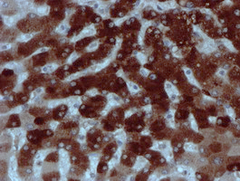 XTP4 / C17orf37 Antibody - IHC of paraffin-embedded Human liver tissue using anti-C17orf37 mouse monoclonal antibody. (Heat-induced epitope retrieval by 10mM citric buffer, pH6.0, 100C for 10min).