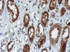 XTP4 / C17orf37 Antibody - IHC of paraffin-embedded Human Kidney tissue using anti-C17orf37 mouse monoclonal antibody. (Heat-induced epitope retrieval by 10mM citric buffer, pH6.0, 100C for 10min).