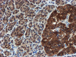 XTP4 / C17orf37 Antibody - IHC of paraffin-embedded Human pancreas tissue using anti-C17orf37 mouse monoclonal antibody. (Heat-induced epitope retrieval by 10mM citric buffer, pH6.0, 100C for 10min).