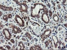 XTP4 / C17orf37 Antibody - IHC of paraffin-embedded Human breast tissue using anti-C17orf37 mouse monoclonal antibody. (Heat-induced epitope retrieval by 10mM citric buffer, pH6.0, 100C for 10min).