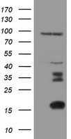 XTP4 / C17orf37 Antibody - HEK293T cells were transfected with the pCMV6-ENTRY control (Left lane) or pCMV6-ENTRY C17orf37 (Right lane) cDNA for 48 hrs and lysed. Equivalent amounts of cell lysates (5 ug per lane) were separated by SDS-PAGE and immunoblotted with anti-C17orf37.