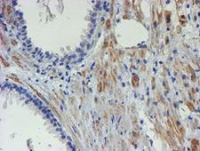 XTP4 / C17orf37 Antibody - IHC of paraffin-embedded Human prostate tissue using anti-C17orf37 mouse monoclonal antibody. (Heat-induced epitope retrieval by 10mM citric buffer, pH6.0, 100C for 10min).