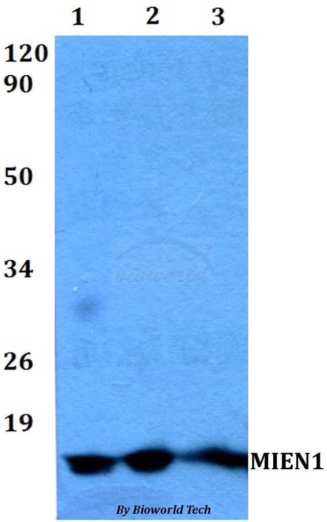 XTP4 / C17orf37 Antibody - Western blot of MIEN1 antibody at 1:500 dilution. Lane 1: MCF-7 whole cell lysate. Lane 2: sp2/0 whole cell lysate. Lane 3: PC12 whole cell lysate.