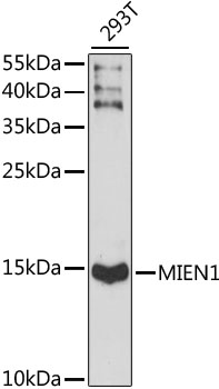 XTP4 / C17orf37 Antibody - Western blot analysis of extracts of 293T cells, using MIEN1 antibody at 1:1000 dilution. The secondary antibody used was an HRP Goat Anti-Rabbit IgG (H+L) at 1:10000 dilution. Lysates were loaded 25ug per lane and 3% nonfat dry milk in TBST was used for blocking. An ECL Kit was used for detection and the exposure time was 90s.