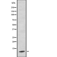 XTP4 / C17orf37 Antibody - Western blot analysis of C17orf37 using K562 whole lysates.