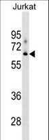 XYLB Antibody - XYLB Antibody western blot of Jurkat cell line lysates (35 ug/lane). The XYLB antibody detected the XYLB protein (arrow).