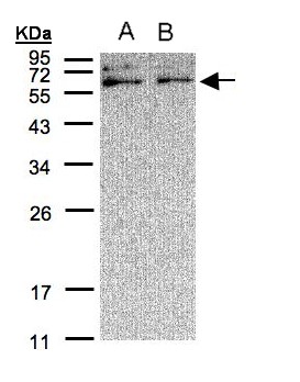 XYLB Antibody - Sample (30 ug of whole cell lysate). A: A431, B: H1299. 12% SDS PAGE. XYLB antibody diluted at 1:500