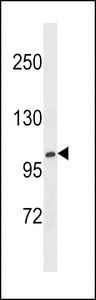 XYLT1 / XylT-I Antibody - XYLT1 Antibody western blot of NCI-H460 cell line lysates (35 ug/lane). The XYLT1 antibody detected the XYLT1 protein (arrow).
