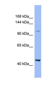 XYLT2 Antibody - XYLT2 antibody Western blot of HT1080 cell lysate. This image was taken for the unconjugated form of this product. Other forms have not been tested.