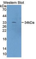 XYLT2 Antibody - Western blot of XYLT2 antibody.