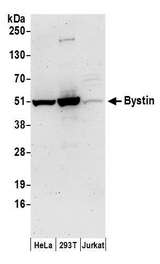Y09766: D.melanogaster Ribosomal Protein L14. [Drosophila melanogaster] Antibody - Detection of human Bystin by western blot. Samples: Whole cell lysate (50 µg) from HeLa, HEK293T, and Jurkat cells prepared using NETN lysis buffer. Antibodies: Affinity purified rabbit anti-Bystin antibody used for WB at 0.4 µg/ml. Detection: Chemiluminescence with an exposure time of 3 minutes.
