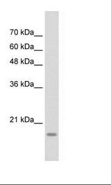 YAF2 Antibody - Jurkat Cell Lysate.  This image was taken for the unconjugated form of this product. Other forms have not been tested.