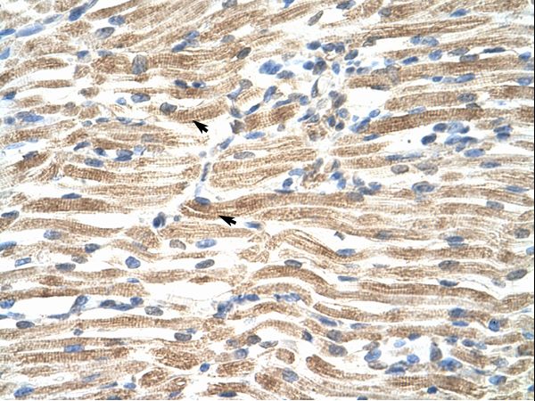 YAF2 Antibody - YAF2 antibody ARP31459_T100-NP_005739-YAF2(YY1 associated factor 2) Antibody was used in IHC to stain formalin-fixed, paraffin-embedded human muscle.  This image was taken for the unconjugated form of this product. Other forms have not been tested.