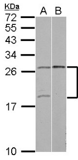 YAF2 Antibody - Sample (30 ug of whole cell lysate) A: 293T B: Raji 15% SDS PAGE YAF2 antibody diluted at 1:500