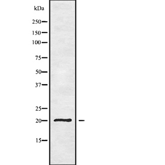 YAF2 Antibody - Western blot analysis of YAF2 using 293 whole cells lysates