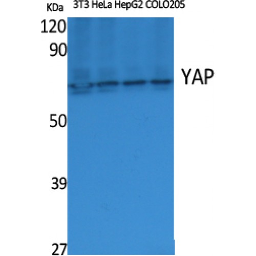 YAP / YAP1 Antibody - Western blot of YAP antibody