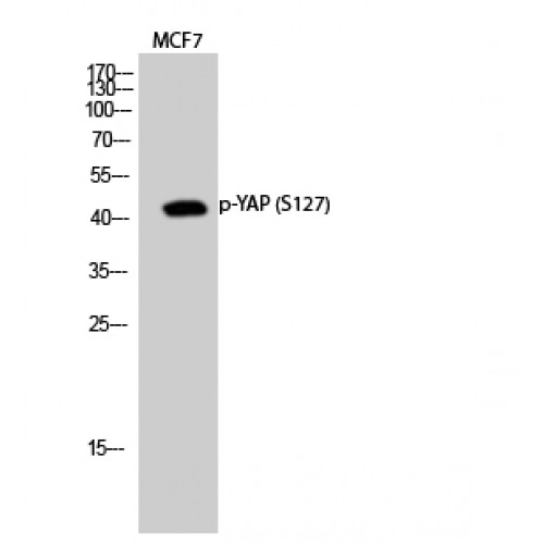 YAP / YAP1 Antibody - Western blot of Phospho-YAP (S127) antibody