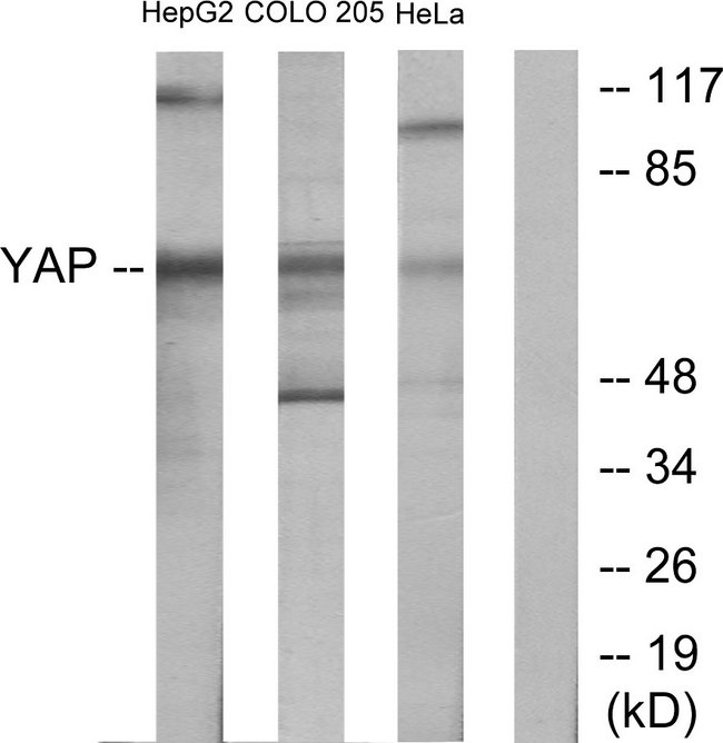YAP / YAP1 Antibody - Western blot analysis of lysates from HeLa, HepG2, and COLO205 cells, using YAP Antibody. The lane on the right is blocked with the synthesized peptide.