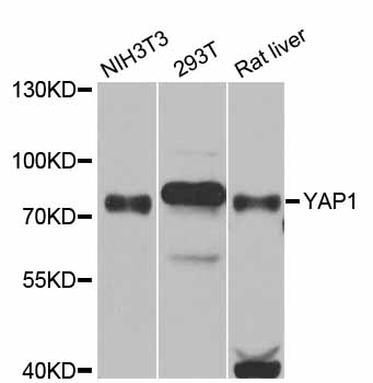 YAP / YAP1 Antibody - Western blot analysis of extracts of various cell lines, using YAP1 antibody at 1:1000 dilution. The secondary antibody used was an HRP Goat Anti-Rabbit IgG (H+L) at 1:10000 dilution. Lysates were loaded 25ug per lane and 3% nonfat dry milk in TBST was used for blocking. An ECL Kit was used for detection and the exposure time was 90s.