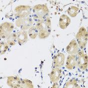 YAP / YAP1 Antibody - Immunohistochemistry of paraffin-embedded human stomach using YAP1 antibodyat dilution of 1:100 (40x lens).