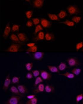YAP / YAP1 Antibody - Immunofluorescence analysis of HeLa cells using YAP1 antibodyat dilution of 1:100. Blue: DAPI for nuclear staining.