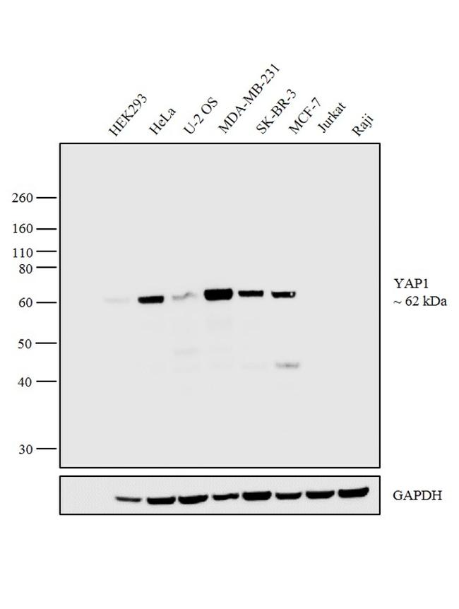 YAP / YAP1 Antibody - YAP1 Antibody in Western Blot (WB)