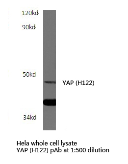 YAP / YAP1 Antibody - Western blot of YAP (H122) pAb in extracts from HepG2 cells.