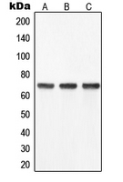 YAP / YAP1 Antibody - Western blot analysis of YAP1 expression in SW480 (A); HeLa (B); Caco2 (C) whole cell lysates.