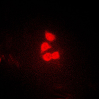YAP / YAP1 Antibody - Immunofluorescent analysis of YAP1 staining in HeLa cells. Formalin-fixed cells were permeabilized with 0.1% Triton X-100 in TBS for 5-10 minutes and blocked with 3% BSA-PBS for 30 minutes at room temperature. Cells were probed with the primary antibody in 3% BSA-PBS and incubated overnight at 4 C in a humidified chamber. Cells were washed with PBST and incubated with a DyLight 594-conjugated secondary antibody (red) in PBS at room temperature in the dark. DAPI was used to stain the cell nuclei (blue).