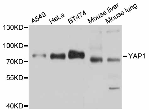 YAP / YAP1 Antibody - Western blot analysis of extracts of various cell lines.