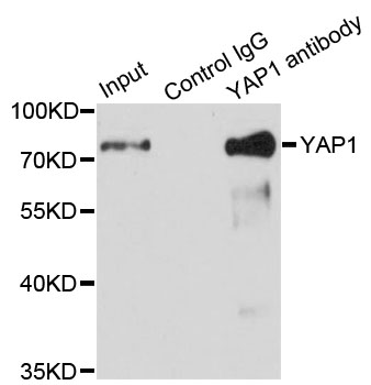 YAP / YAP1 Antibody - Immunoprecipitation analysis of 150ug extracts of HeLa cells.