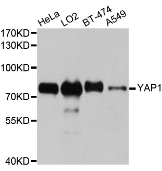 YAP / YAP1 Antibody - Western blot analysis of extracts of various cell lines, using YAP1 antibody at 1:1000 dilution. The secondary antibody used was an HRP Goat Anti-Rabbit IgG (H+L) at 1:10000 dilution. Lysates were loaded 25ug per lane and 3% nonfat dry milk in TBST was used for blocking. An ECL Kit was used for detection and the exposure time was 10s.