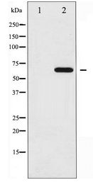 YAP / YAP1 Antibody - Western blot of YAP expression in Wortmannin treated HepG2 whole cell lysates,The lane on the left is treated with the antigen-specific peptide.