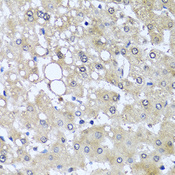 YAP / YAP1 Antibody - Immunohistochemistry of paraffin-embedded human liver injury using YAP1 antibody at dilution of 1:100 (40x lens).