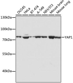 YAP / YAP1 Antibody - Western blot analysis of extracts of various cell lines using YAP1 Polyclonal Antibody at dilution of 1:1000.