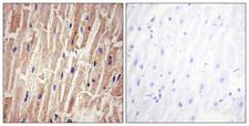 YAP / YAP1 Antibody - Immunohistochemistry analysis of paraffin-embedded human heart , using YAP (Phospho-Ser127) Antibody. The picture on the right is blocked with the phospho peptide.