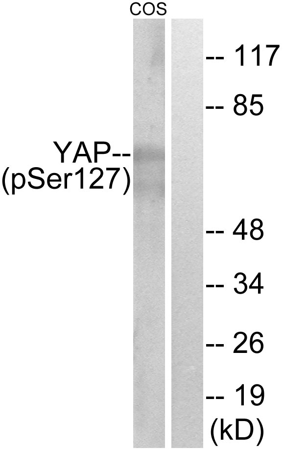 YAP / YAP1 Antibody - Western blot analysis of lysates from COS7 cells treated with HU 2nM 24h, using YAP (Phospho-Ser127) Antibody. The lane on the right is blocked with the phospho peptide.