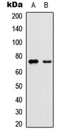 YAP / YAP1 Antibody - Western blot analysis of YAP1 (pS127) expression in MCF7 (A); PC3 (B) whole cell lysates.
