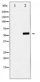 YAP / YAP1 Antibody - Western blot of YAP phosphorylation expression in COS7 whole cell lysates,The lane on the left is treated with the antigen-specific peptide.
