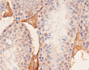 YAP / YAP1 Antibody - 1:100 staining mouse kidney tissue by IHC-P. The tissue was formaldehyde fixed and a heat mediated antigen retrieval step in citrate buffer was performed. The tissue was then blocked and incubated with the antibody for 1.5 hours at 22°C. An HRP conjugated goat anti-rabbit antibody was used as the secondary.