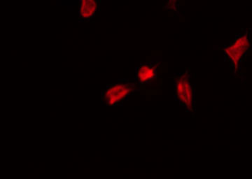 YAP / YAP1 Antibody - Staining HeLa cells by IF/ICC. The samples were fixed with PFA and permeabilized in 0.1% Triton X-100, then blocked in 10% serum for 45 min at 25°C. The primary antibody was diluted at 1:200 and incubated with the sample for 1 hour at 37°C. An Alexa Fluor 594 conjugated goat anti-rabbit IgG (H+L) Ab, diluted at 1/600, was used as the secondary antibody.